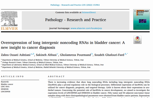 Overexpression of long intergenic noncoding RNAs in bladder cancer: A new insight to cancer diagnosis